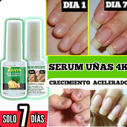 NailRevita Pro™ -Fortaleza y Crecimiento Superior para Tus Uñas