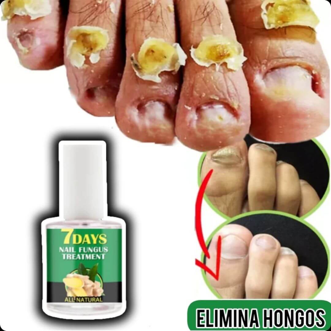 NailRevita Pro™ -Fortaleza y Crecimiento Superior para Tus Uñas