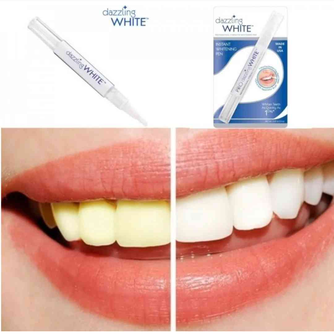 🎁 Paga 1 lleva 3 - LANTHOME™ Esencia Blanqueadora de Dientes